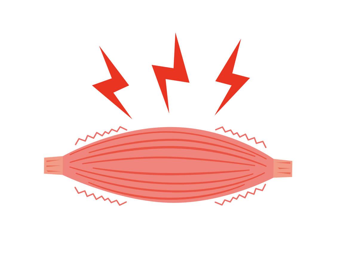 cpd-AIFiMM-Formazione-Sustained-muscle-contractions