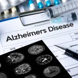 What is Alzheimer's Disease?